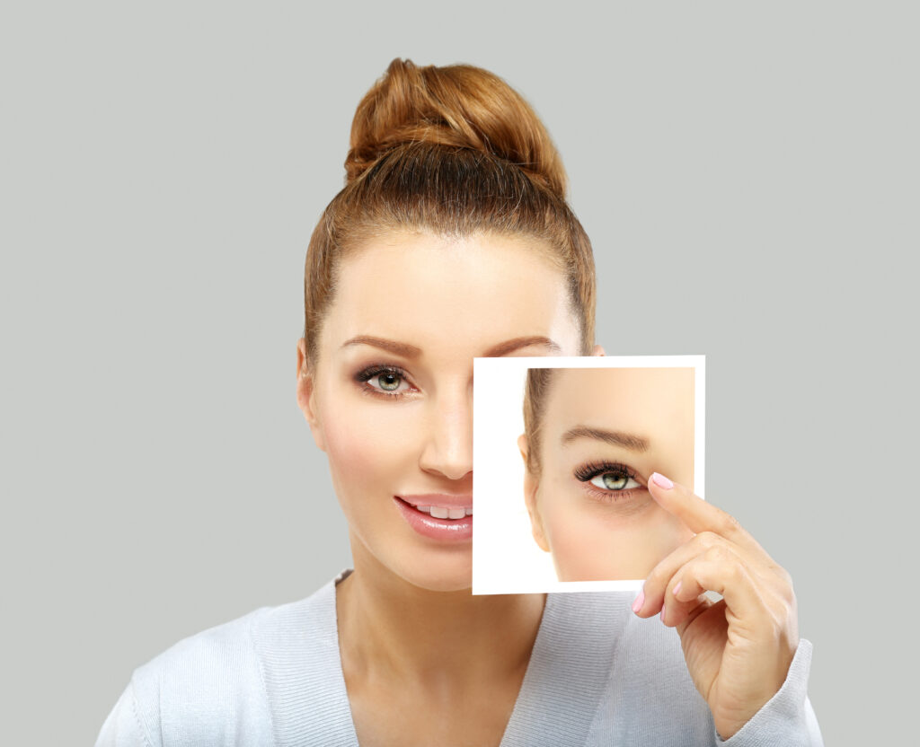 Blepharoplasty Eyelid Surgery Delaware | Premier Cosmetic Surgery DE