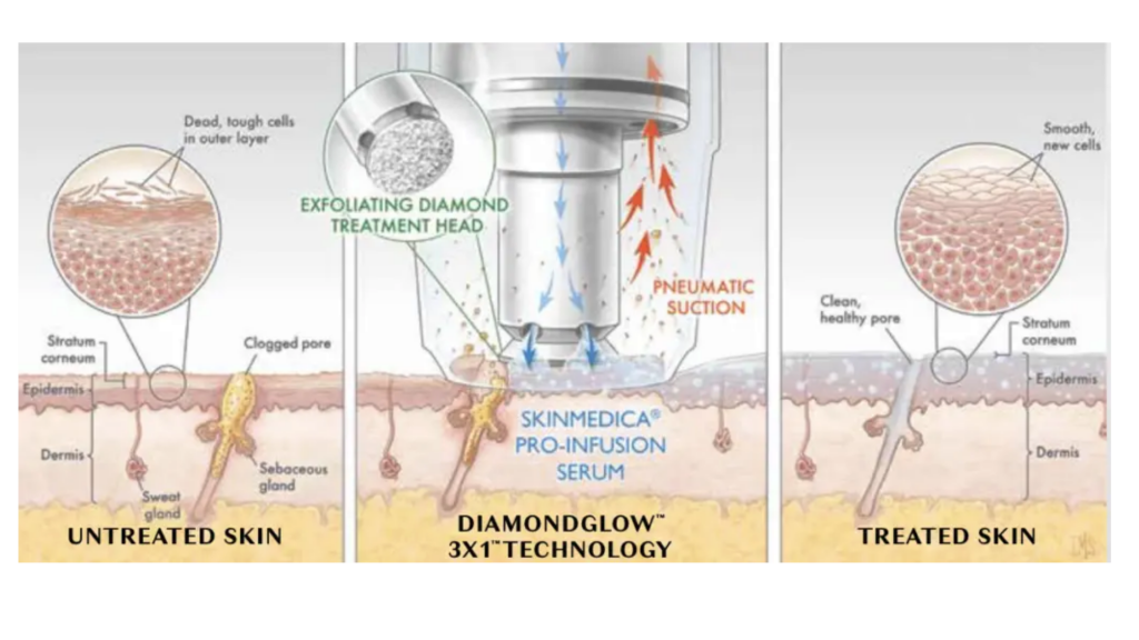 Diamond Glow | Premier Cosmetic Surgery DE